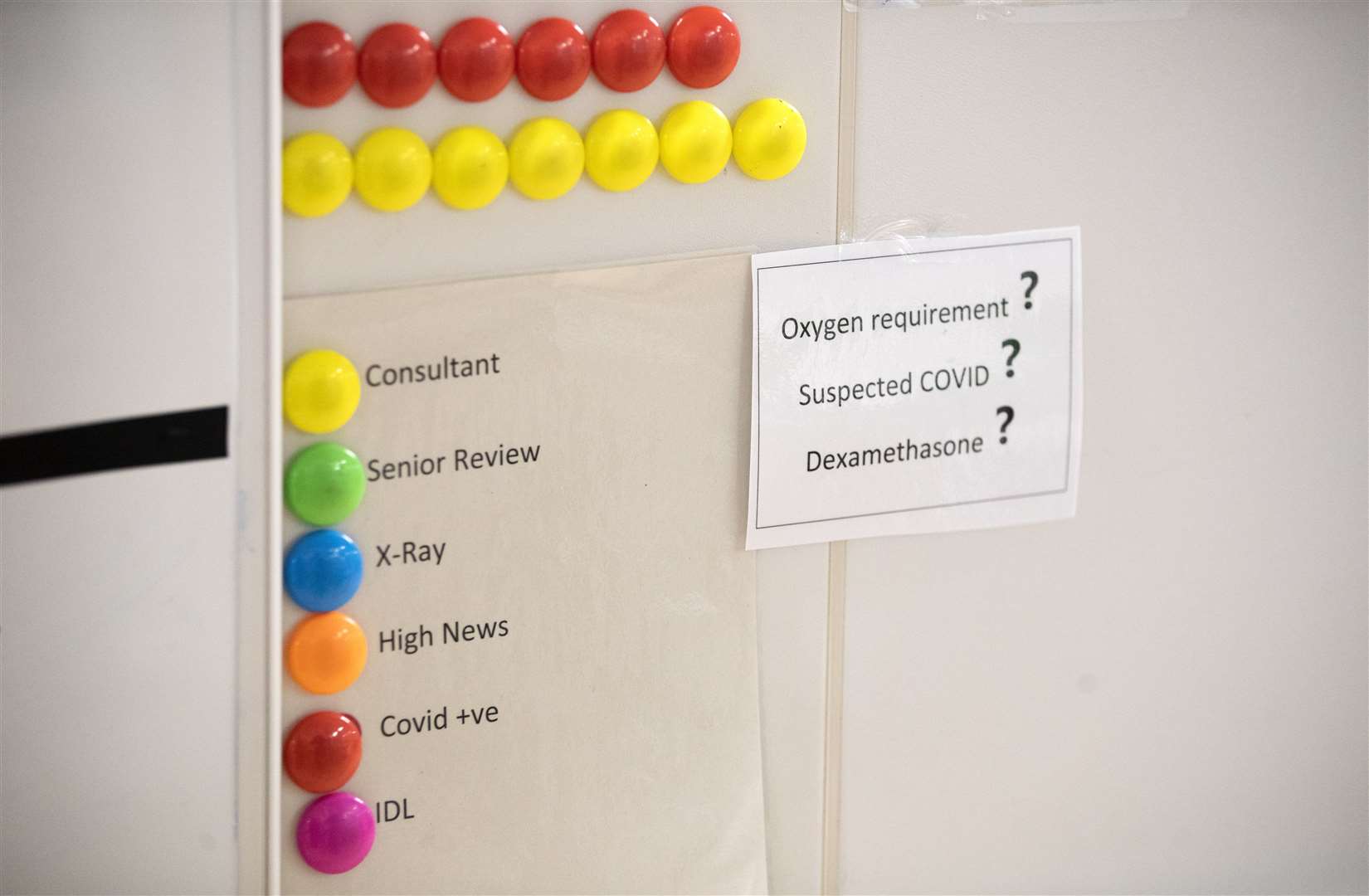 Patient charts on the wall of the specialist assessment and treatment area (Jane Barlow/PA)