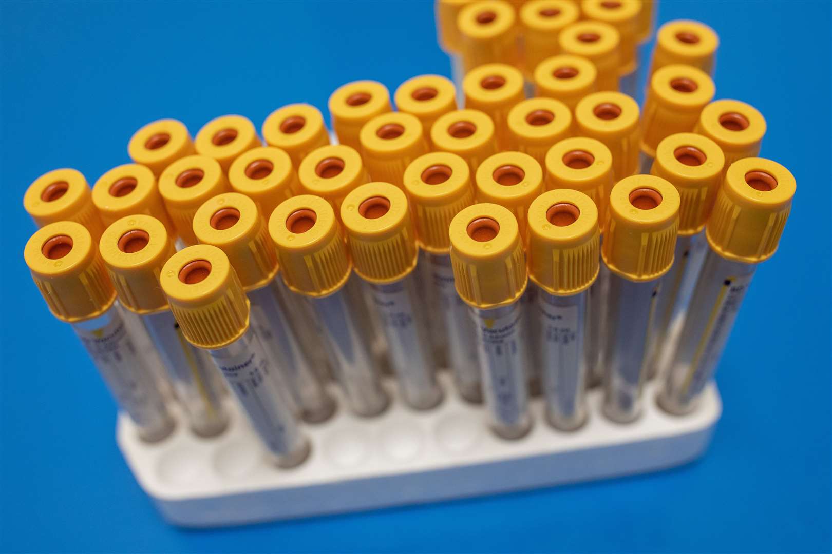 Test tubes to be used for blood samples sit on a table at a coronavirus antibody testing programme (Simon Dawson/PA)