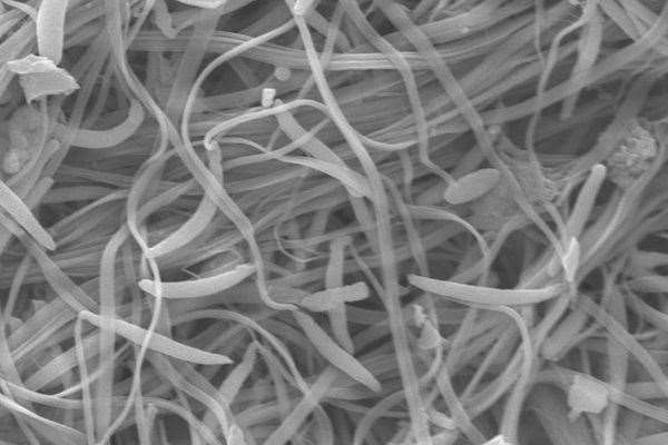 A high magnification picture using a scanning electron microscope (SEM) photo of some echinogammarus marinus sperm (University of Portsmouth/PA)