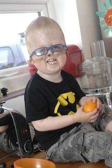 Stanley Turner (three) who has Crouzon syndrome at home in Herne Bay