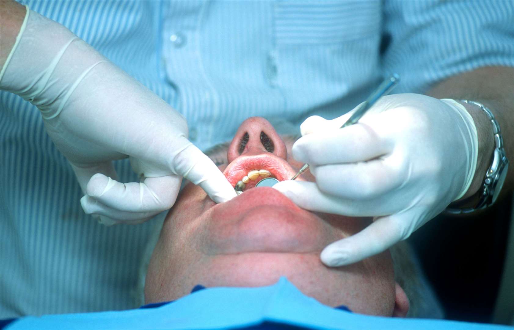 MPs have heard that patients are traveling hundreds of miles to find an NHS dentist (Alamy/PA)