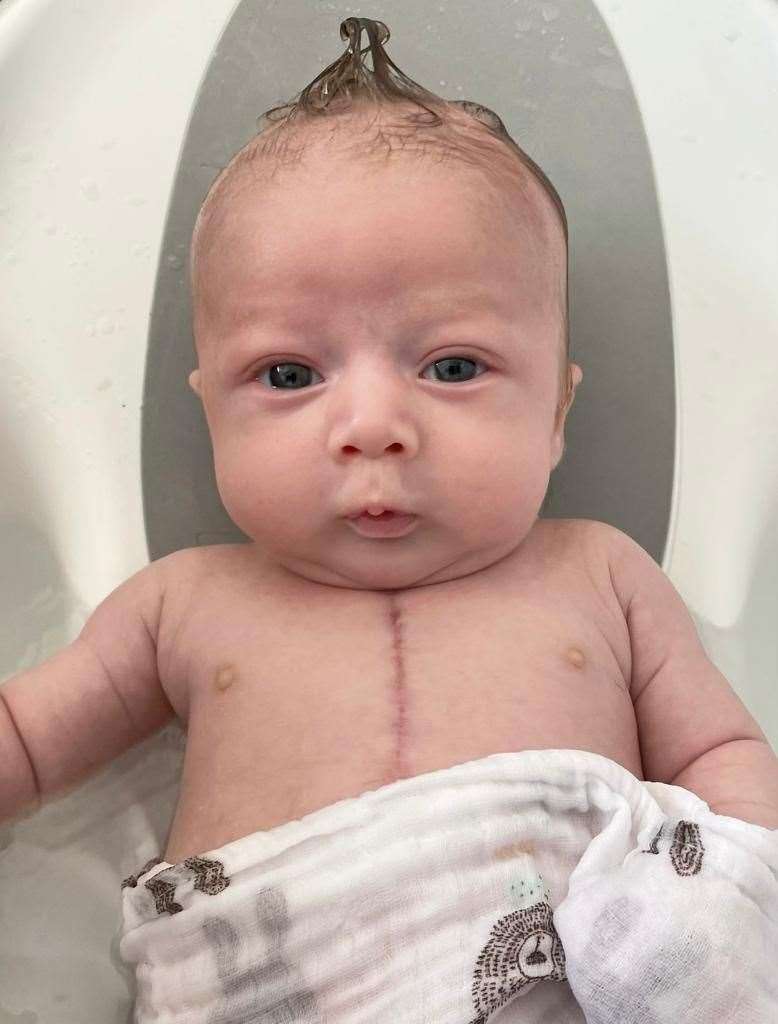 Baby Phoenix showing off his new scar. Picture: Leah Edwards (57215185)