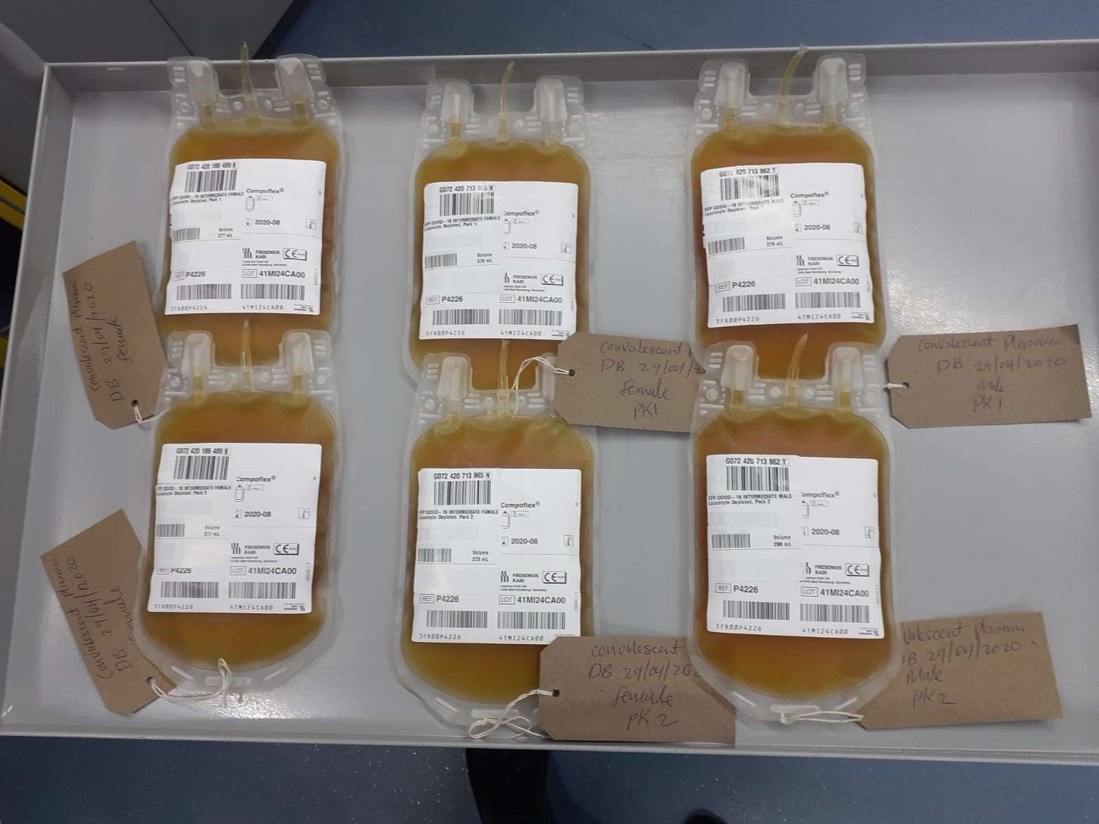 Plasma is being collected as part of a trial for a possible coronavirus treatment (NHS Blood and Transplant/PA)