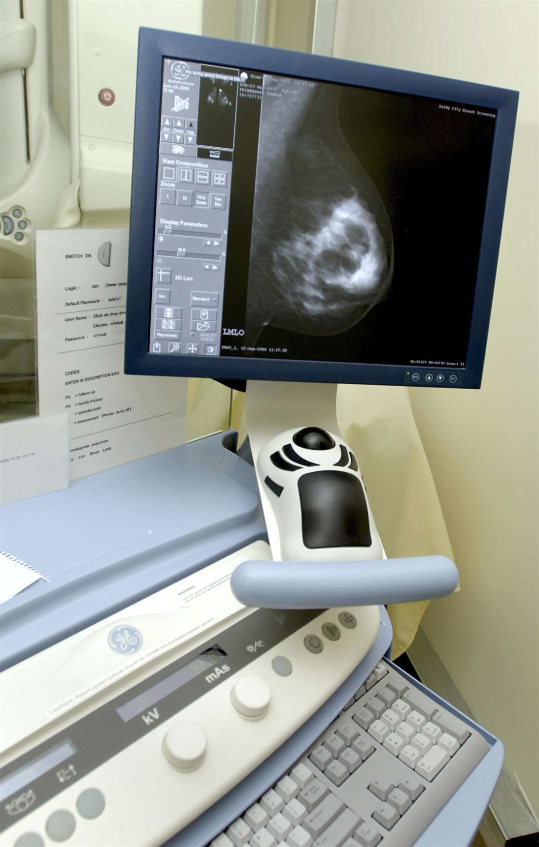 Preliminary trial results suggest AI is safe to use in reading breast cancer scans (Rui Vieira/PA)