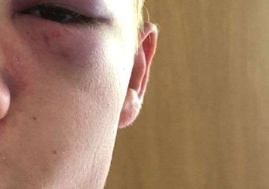 An investigation has been launched after a schoolboy was viciously attacked