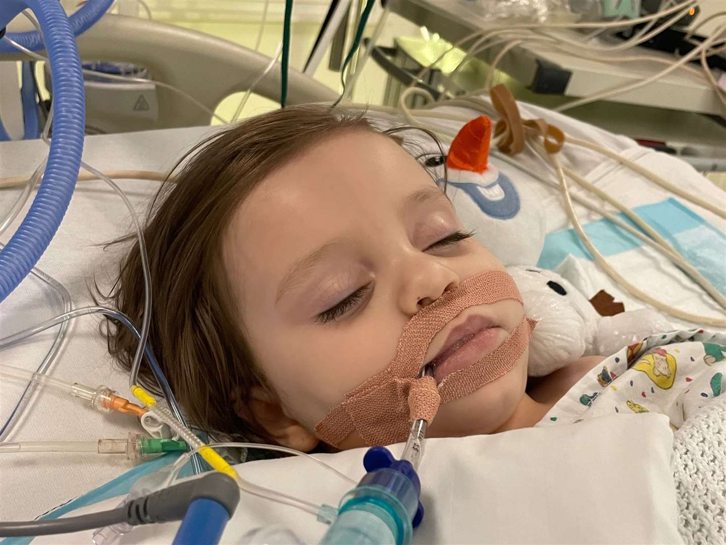 Leilani was in intensive care for a few days after her heart operation. Picture: Louise Aisthorpe