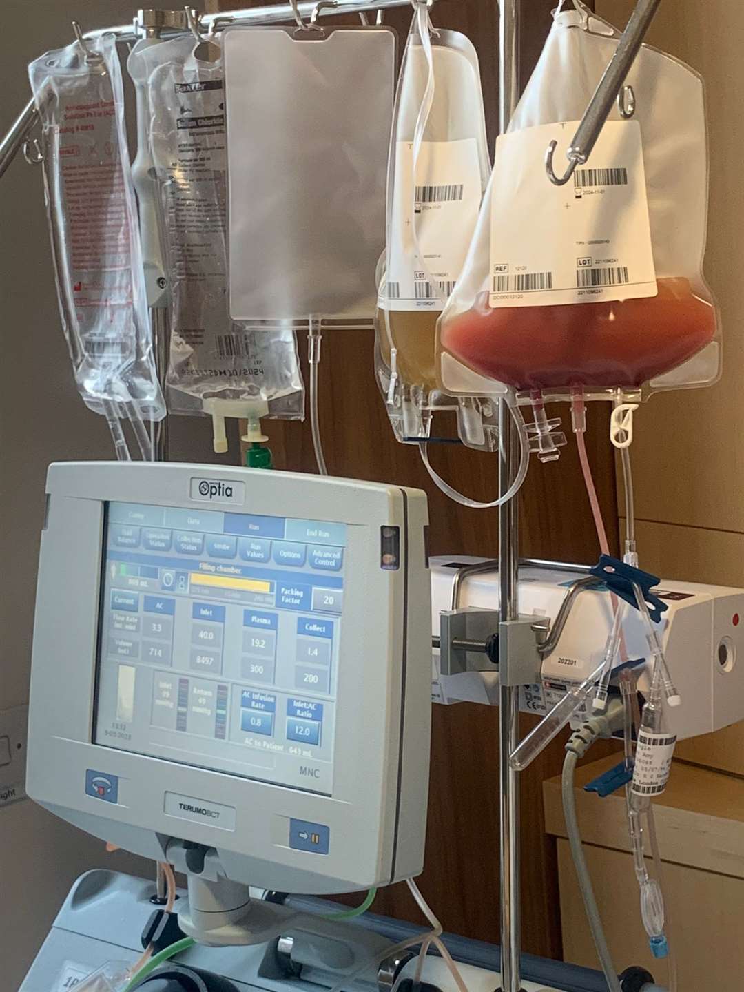 Machines showing stem cell separated from blood after teacher Amy Pringle donated hers (Amy Pringle/PA)