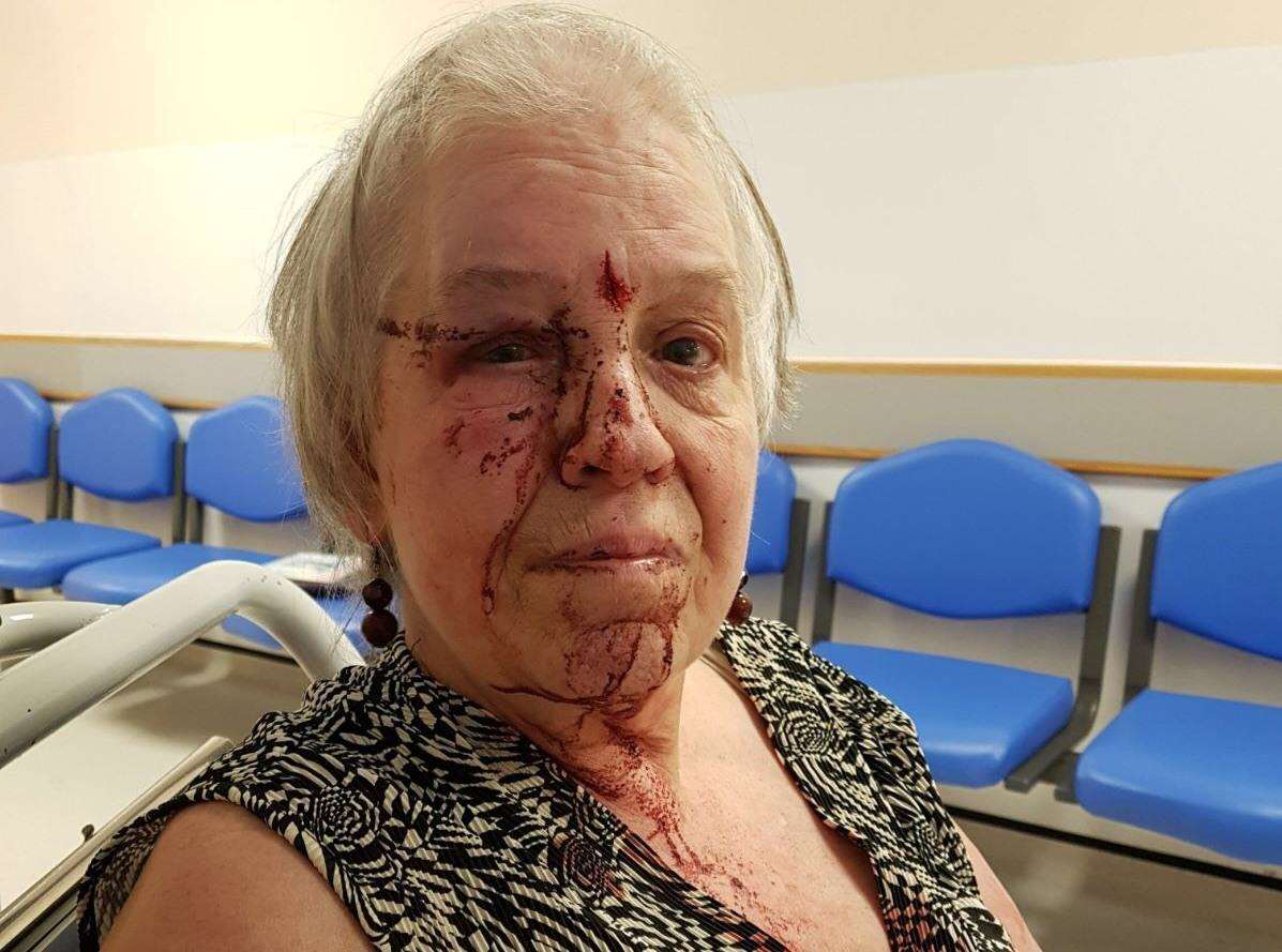 Lesley Wilson, 69, was punched and kicked when she had her handbag stolen