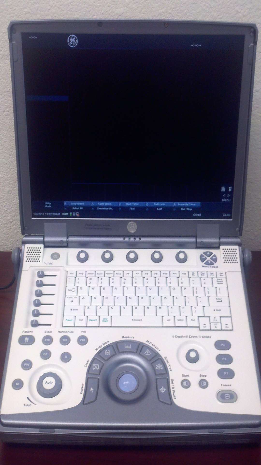 Stolen ultrasound scanner