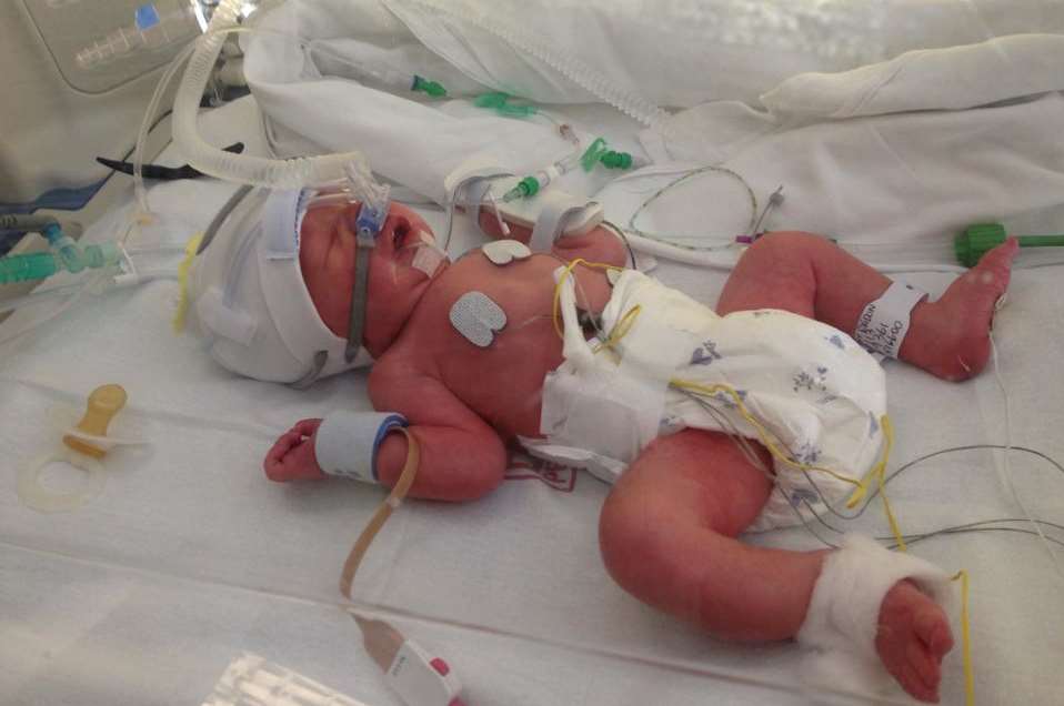 Harry in intensive care at the William Harvey hospital in Ashford