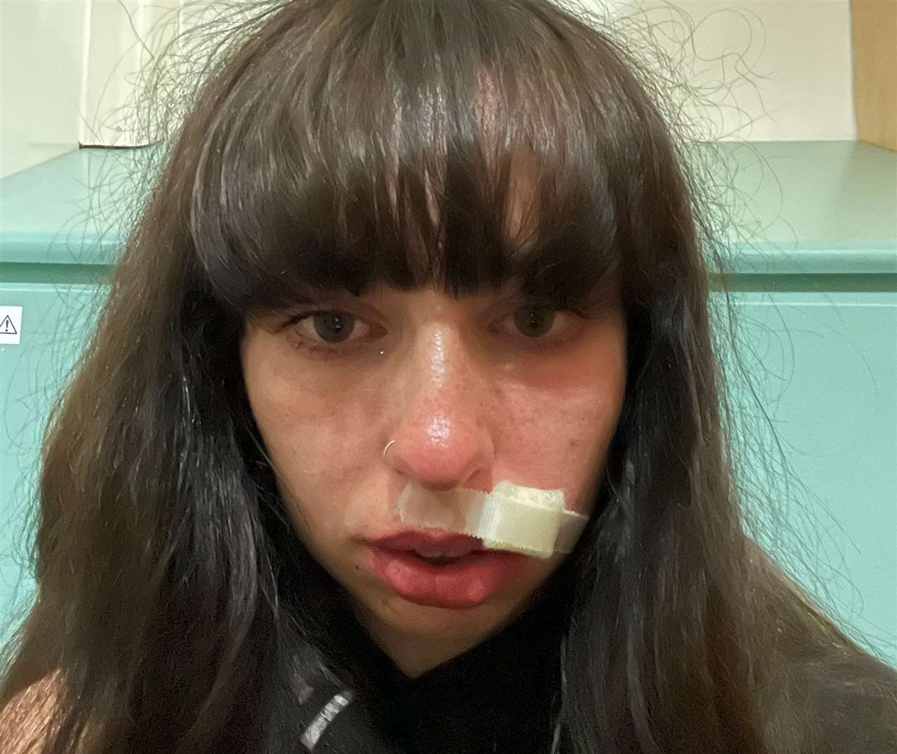 Daisy Foster was attacked on her way home from university in Birmingham. Picture: Daisy Foster