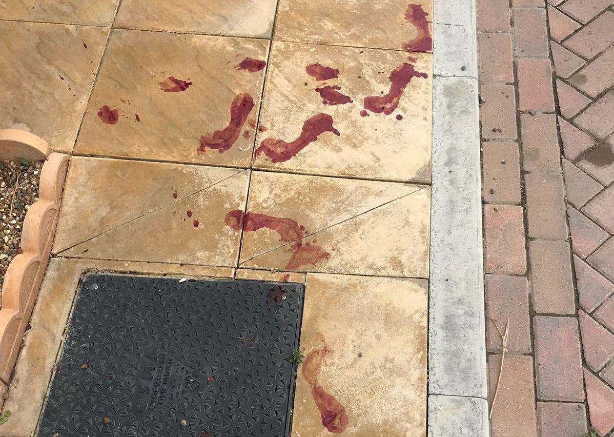 A blood-splattered driveway after the alleged dog attack