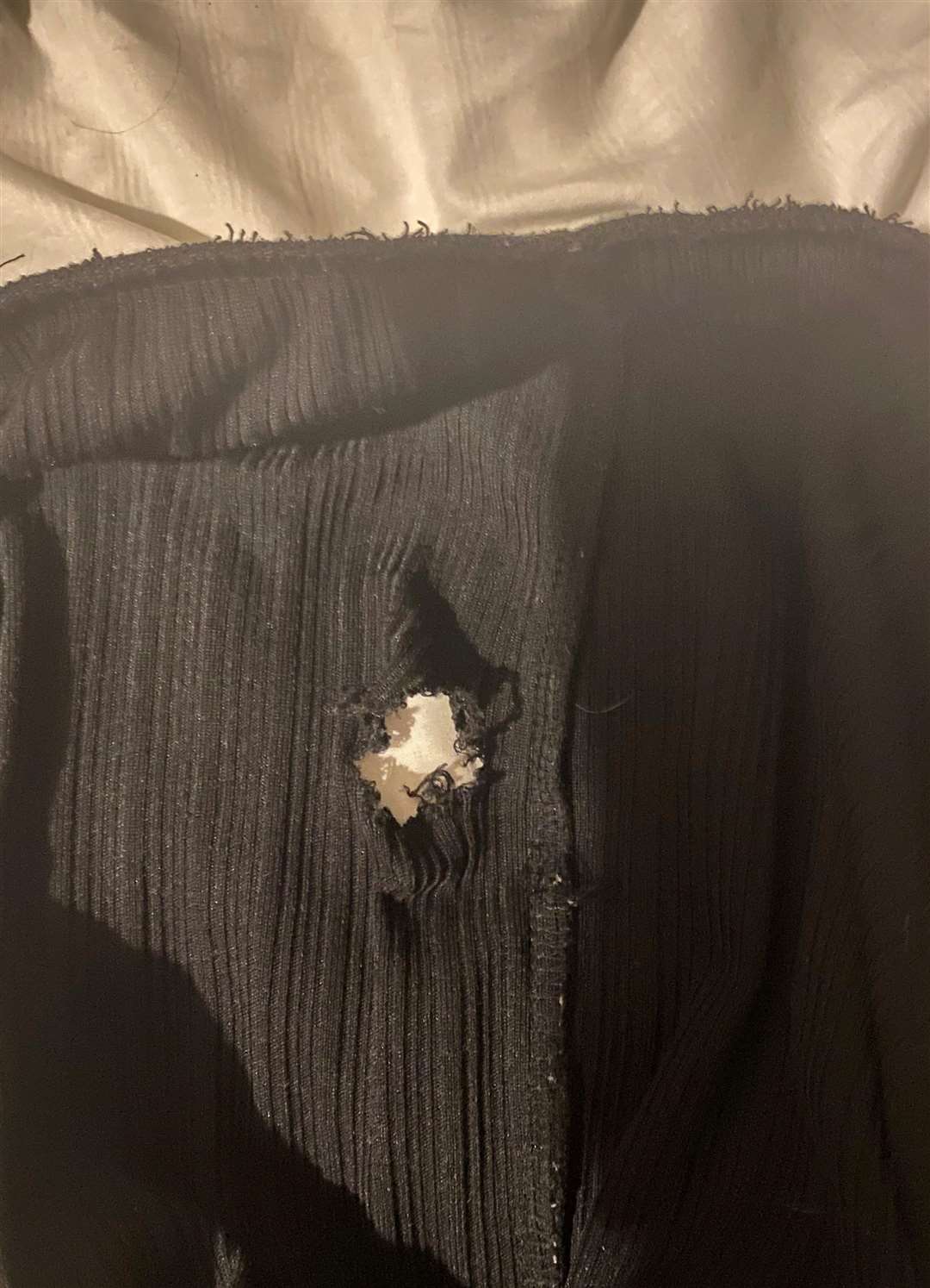 Hole in Lanette Wiltshire's trousers from the cow attack. Picture: SWNS