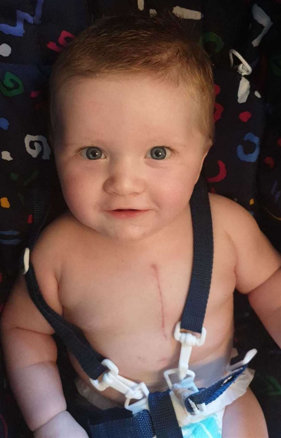 Jacob underwent heart surgery at six months old. Picture: Shona Boyle