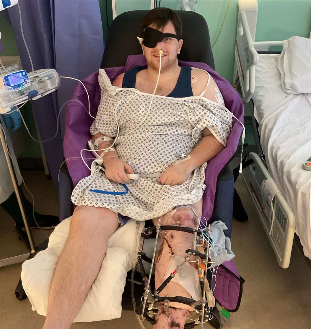 Jordan Collins, from Manston, was left with life-changing injuries after a crash involving a bike and a car near St Peter's Road, Broadstairs on July 27. Picture: Shayla Raine