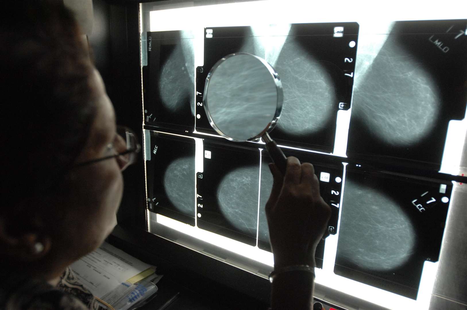 Breast Cancer screening unit. Stock image